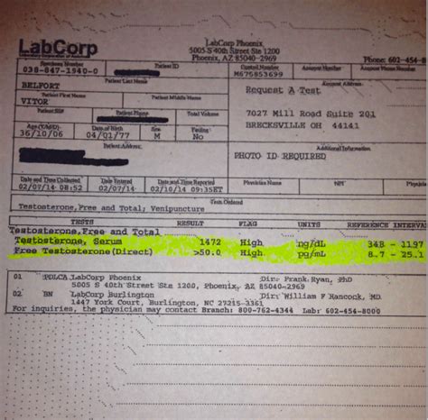 About Labcorp. . Labcorp drug test appointment